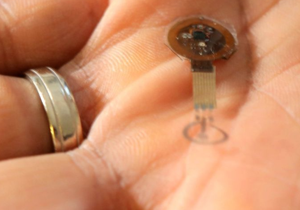 Des bandages et des capteurs biod&eacute;gradables et disparaissant permettent une surveillance et une gu&eacute;rison durables